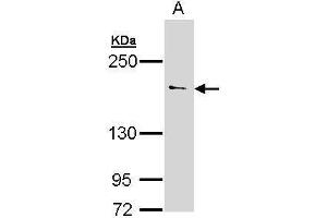 WB Image Sample (30 ug of whole cell lysate) A: 293T 5% SDS PAGE antibody diluted at 1:500
