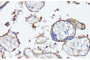 Immunohistochemistry (Paraffin-embedded Sections) (IHC (p)) image for anti-Mucosal Vascular Addressin Cell Adhesion Molecule 1 (MADCAM1) antibody (ABIN7010289)