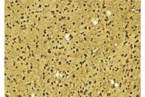 ABIN6275631 at 1/100 staining Mouse brain tissue by IHC-P. (TIGD3 Antikörper  (Internal Region))