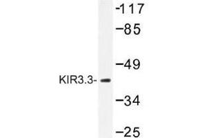Image no. 1 for anti-Potassium Inwardly-Rectifying Channel, Subfamily J, Member 9 (KCNJ9) antibody (ABIN317838) (KCNJ9 Antikörper)