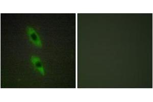 Immunofluorescence analysis of HuvEc cells, using FADD Antibody. (FADD Antikörper  (AA 101-150))