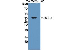 Detection of Recombinant ST2, Human using Polyclonal Antibody to Syntenin 2 (ST2) (SDCBP2 Antikörper  (AA 1-292))