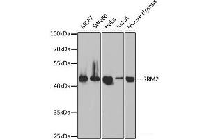Western blot analysis of extracts of various cell lines using RRM2 Polyclonal Antibody at dilution of 1:1000. (RRM2 Antikörper)