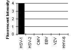 Cross Reactivity Results determined by IFA (HSV1 gE Antikörper)