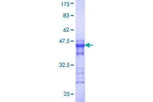 SPA17 Protein (AA 51-149) (GST tag)