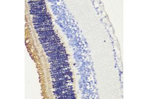 Immunohistochemistry of paraffin-embedded mouse retina using Rhodopsindopsin antibody (ABIN7269975) at dilution of 1:200 (40x lens). (Rho-related GTP-binding protein Antikörper  (C-Term))