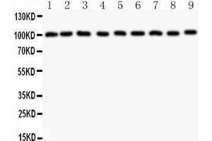 Western Blotting (WB) image for anti-Cas-Br-M (Murine) Ecotropic Retroviral Transforming Sequence (CBL) (AA 556-906) antibody (ABIN3043746) (CBL Antikörper  (AA 556-906))