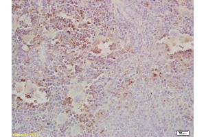 Formalin-fixed and paraffin embedded mouse spleen labeled with Anti-Gab2 Polyclonal Antibody, Unconjugated (ABIN681178) at 1:200, followed by conjugation to the secondary antibody and DAB staining (GAB2 Antikörper  (AA 601-676))