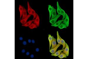 ABIN7097156 and ABIN7101224 staining Hela cells by IF/ICC. (CPQ Antikörper)