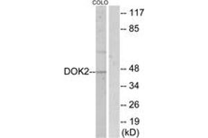 Western blot analysis of extracts from COLO205, using p56 Dok-2 (Ab-299) Antibody.