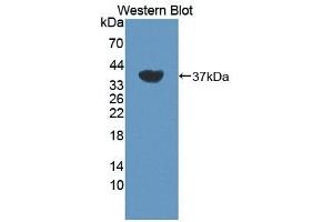 Detection of Recombinant DYRK1A, Human using Polyclonal Antibody to Dual Specificity Tyrosine Phosphorylation Regulated Kinase 1A (DYRK1A) (DYRK1A Antikörper  (AA 16-300))