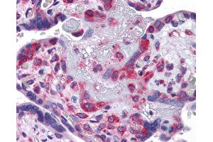 Immunohistochemistry (IHC) image for anti-Y Box Binding Protein 1 (YBX1) (Middle Region) antibody (ABIN2775773)