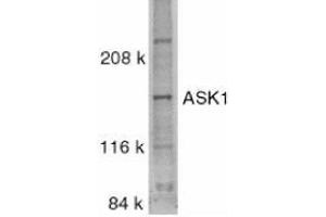 Western blot analysis of ASK1 in SW1353 whole cell lysate with AP30085PU-N ASK1 antibody at 1/500 dilution. (ASK1 Antikörper  (C-Term))