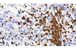 Immunohistochemistry (IHC) image for anti-Caspase 1 (CASP1) (AA 120-297) antibody (ABIN7433831)