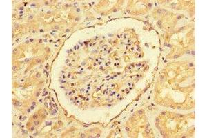 Immunohistochemistry of paraffin-embedded human kidney tissue using ABIN7151461 at dilution of 1:100 (EHD3 Antikörper  (AA 269-498))