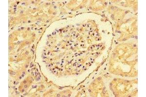 Immunohistochemistry of paraffin-embedded human kidney tissue using ABIN7151461 at dilution of 1:100 (EHD3 Antikörper  (AA 269-498))