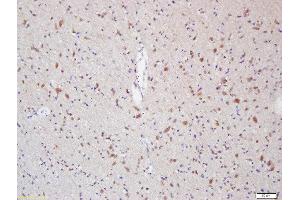 Formalin-fixed and paraffin embedded rat brain labeled with Anti-Myelin Protein Zero Polyclonal Antibody, Unconjugated  at 1:200 followed by conjugation to the secondary antibody and DAB staining (MPZ Antikörper  (AA 175-248))