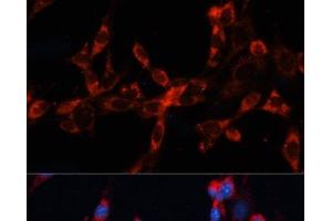 Immunofluorescence analysis of NIH/3T3 cells using CTSL Polyclonal Antibody at dilution of 1:100. (Cathepsin L Antikörper)