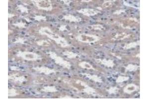 Immunohistochemistry (IHC) image for anti-Ubiquitin-Conjugating Enzyme E2L 3 (UBE2L3) (AA 4-154) antibody (ABIN7441196)