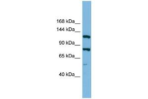 WB Suggested Anti-HYOU1 Antibody Titration: 0. (HYOU1 Antikörper  (Middle Region))
