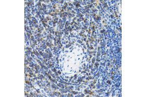 Immunohistochemistry of paraffin-embedded rat spleen using SRP19 antibody (ABIN2560139) at dilution of 1:100 (40x lens). (SRP19 Antikörper)
