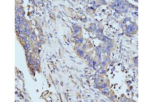 IHC analysis of BZW2 using anti-BZW2 antibody (ABIN7600608).