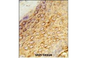 Formalin-fixed and paraffin-embedded human skin tissue reacted with LDHA Antibody (Center), which was peroxidase-conjugated to the secondary antibody, followed by DAB staining. (Lactate Dehydrogenase A Antikörper  (AA 154-182))