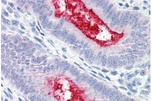 Anti-ENPP3 antibody  ABIN1048561 IHC staining of human uterus. (ENPP3 Antikörper  (Internal Region))