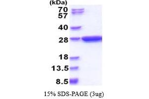 SDS-PAGE (SDS) image for Glutathione S Transferase (GST) (AA 1-224) protein (ABIN667069)