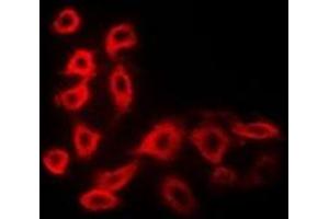 Immunofluorescent analysis of Cytochrome P450 51A1 staining in MCF7 cells. (CYP51A1 Antikörper)