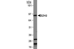 Western blot analysis of EZH2 in Jurkat whole cell lysate using EZH2 polyclonal antibody .