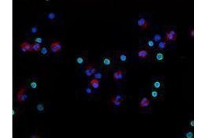 Immunofluorescence (IF) image for anti-Integrin alpha M (ITGAM) antibody (Alexa Fluor 594) (ABIN2656814) (CD11b Antikörper  (Alexa Fluor 594))