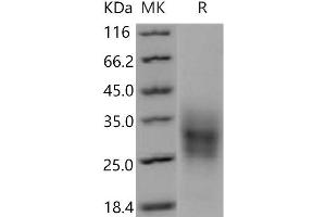 Western Blotting (WB) image for Tumor Necrosis Factor Receptor Superfamily, Member 10b (TNFRSF10B) (Active) protein (His tag) (ABIN7198413) (TNFRSF10B Protein (His tag))
