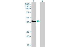 Western Blot analysis of SGK2 expression in transfected 293T cell line by SGK2 monoclonal antibody (M04A), clone 4B12. (SGK2 Antikörper  (AA 293-367))