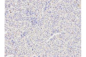 Immunohistochemistry of paraffin-embedded mouse kidney using FAS antibody at dilution of 1:400 (200x lens).
