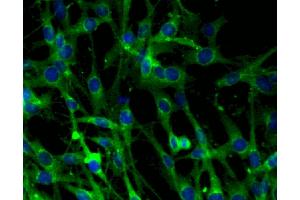 Immunofluorescent staining of C6 cells (right). (Clathrin Antikörper  (AA 4-171))