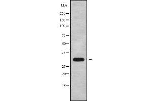 Western blot analysis of CABP4 using Jurkat whole cell lysates