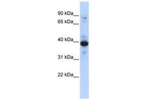 Image no. 1 for anti-Ring Finger Protein 34 (RNF34) (AA 143-192) antibody (ABIN6742950)
