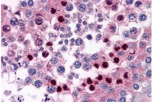 Immunohistochemistry (Formalin-fixed Paraffin-embedded Sections) (IHC (fp)) image for anti-Coronin, Actin Binding Protein, 1B (CORO1B) (AA 1-490) antibody (ABIN574458)