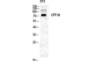 Western Blot (WB) analysis of NIH-3T3 cells using CPTI-M Polyclonal Antibody. (CPT1B Antikörper  (Internal Region))
