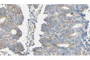 ABIN6276484 at 1/100 staining Human prostate tissue by IHC-P. (ARPC1A Antikörper  (C-Term))