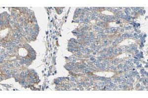 ABIN6276484 at 1/100 staining Human prostate tissue by IHC-P.