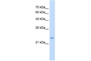 CHIC1 antibody used at 5 ug/ml to detect target protein. (CHIC1 Antikörper  (N-Term))