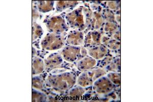 Immunohistochemistry (Paraffin-embedded Sections) (IHC (p)) image for anti-ATPase, Na+/K+ Transporting, beta 3 Polypeptide (ATP1B3) (AA 241-270), (C-Term) antibody (ABIN656673)