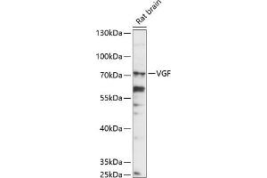 Western blot analysis of extracts of rat brain, using VGF antibody (ABIN7271321) at 1:1000 dilution.