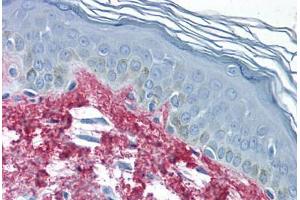 Human Skin (formalin-fixed, paraffin-embedded) stained with Collagen I antibody ABIN291823 at 2. (Collagen Type I Antikörper)