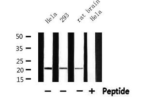 Western blot analysis of extracts from 293 and hela and rat brain, using MRPL11 Antibody.