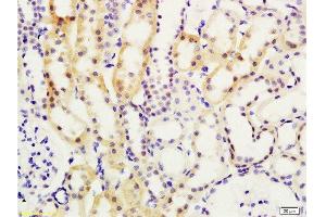 Immunohistochemistry (Paraffin-embedded Sections) (IHC (p)) image for anti-SMAD, Mothers Against DPP Homolog 7 (SMAD7) (AA 1-100) antibody (ABIN670206)
