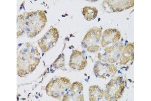 Immunohistochemistry of paraffin-embedded Human stomach using USH1C Polyclonal Antibody at dilution of 1:100 (40x lens).