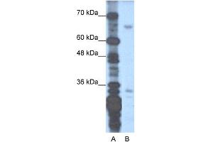 WB Suggested Anti-ZNF691 Antibody Titration:  1. (ZNF691 Antikörper  (N-Term))